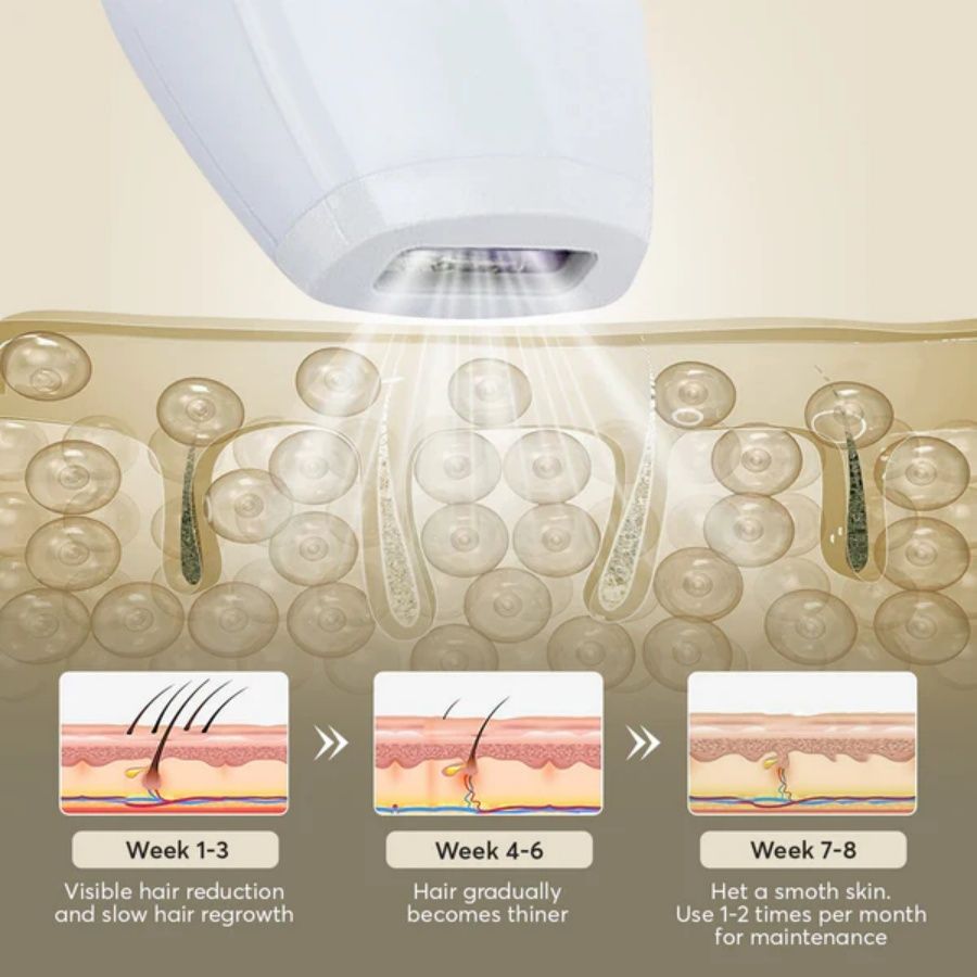 Professional Laser Epilator IPL Hair Removal Device | Body, Bikini & Leg Depilatory