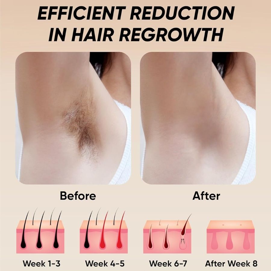 Professional Laser Epilator IPL Hair Removal Device | Body, Bikini & Leg Depilatory